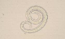 Trichinella spiralis